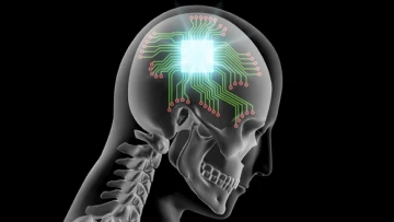 Neurology: нейрочипы BrainGate в испытаниях показали низкую частоту нежелательных эффектов