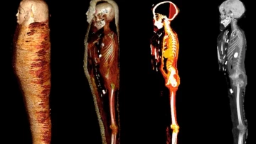 Ученые изучили мумию «Золотого мальчика» и выяснили, что мумифицировали не только египтян