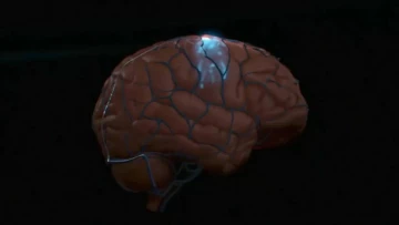 JAMA Neurology: имплантат поможет парализованным людям управлять компьютером