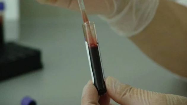 Ученые узнали, носители какой группы крови живут дольше