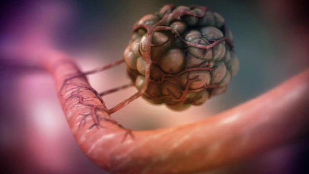 «КТВ-Луч»: Онколог Фролов перечислил семь самых первых симптомов рака легких