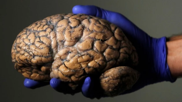 Учёные обнаружили, что COVID-19 оказывает влияние на функции мозга