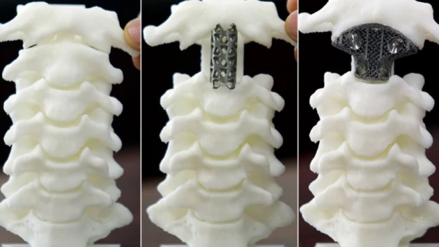 В Иванове создают импланты костей человека с помощью 3D-печати