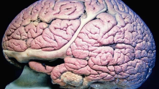 IvanovoNews: нейрохирурги впервые смогли удалить коллоидную кисту головного мозга