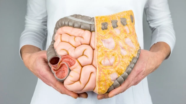 Gastroenterology: Жир на животе мешает приему лекарств от заболеваний системы пищеварения