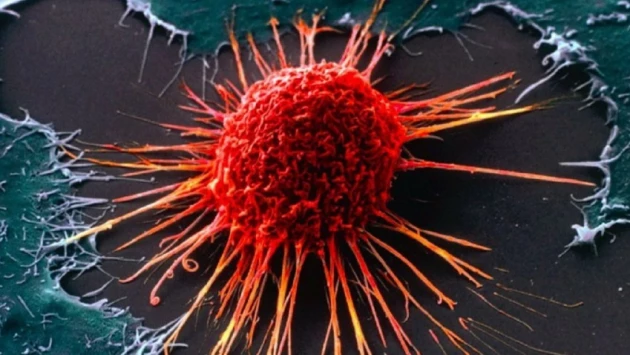 В Сеченовском Университете нашли способ прогнозировать рак за несколько лет до развития опухоли