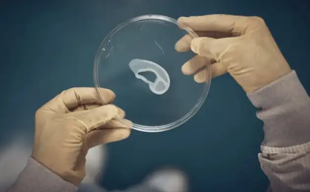 Врачи смогли пересадить пациентке напечатанное на 3D-принтере ухо из собственных клеток человека
