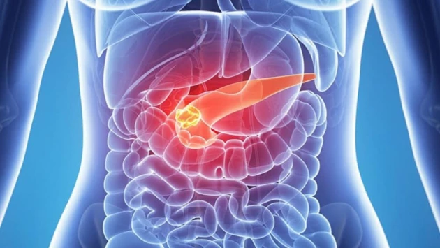 LS: положение поджелудочной железы после лечения рака желудка может повлиять на появление свищей