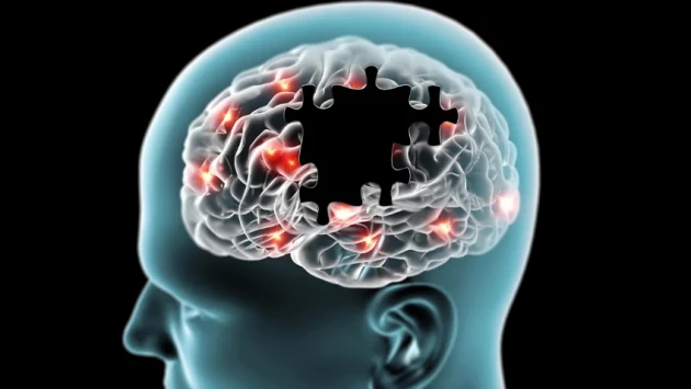 Natural: плохо изолированные нервные клетки способствуют болезни Альцгеймера в пожилом возрасте