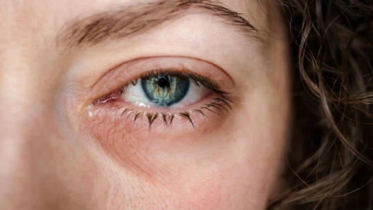 BJO: повторные случаи заболевания глаз токсоплазмозом чаще наблюдаются у женщин