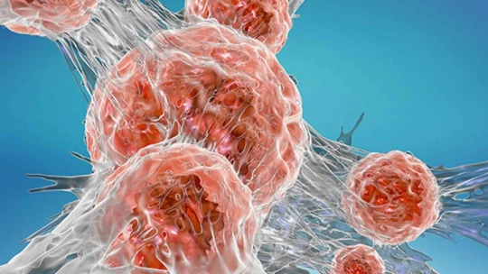 РИАН: в ТМУ обнаружили маркер метастазирования рака простаты с чувствительностью до 72%