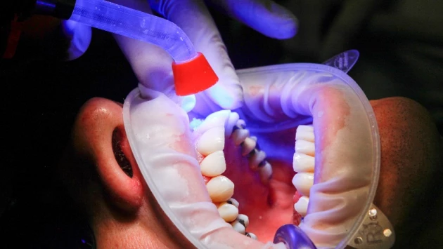 Врачи назвали 5 причин полной потери зубов