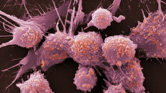Ученые из ИИКС НИЯУ МИФИ выяснили, что от химиотерапии опухоль может стареть, но не умирать