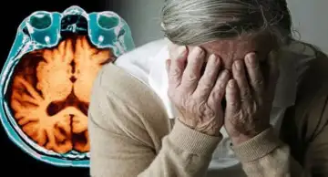 Эксперты заявляют, что телефоны могут спровоцировать болезнь Альцгеймера