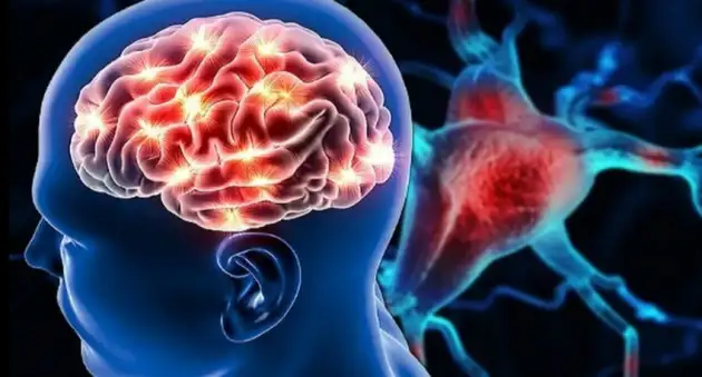 Противоэпилептический препарат ускоряет восстановление мозга после инсульта