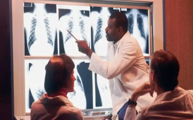 Искусственный интеллект научился угадывать расу человека по рентгену