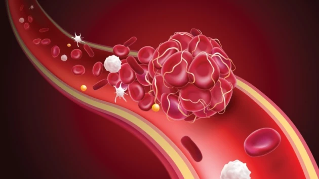 Употребление каннабиса повышает шанс развития заболевания периферических артерий в 3 раза