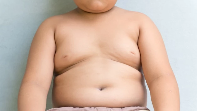 CRM: Сыновья женщин с синдромом поликистозных яичников в три раза чаще страдают ожирением