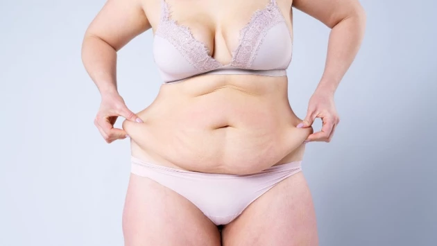 Врачи сообщили, что желудочный баллон может помочь потерять 74% лишнего веса