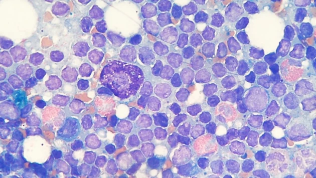 Исследование: тучные клетки оказывают важное влияние на развитие хронического миелоидного лейкоза