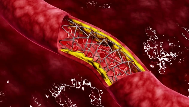 Ученые опубликовали рецепт создания клеток кровеносных сосудов из стволовых клеток пациента