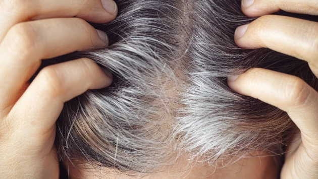 "Пассивность" клеток волоса: что влияет на изменение цвета волос