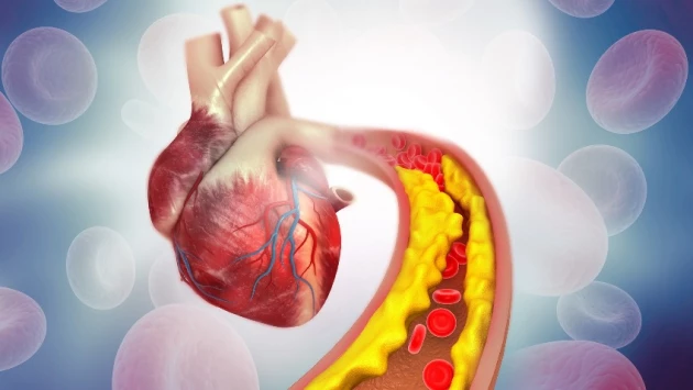 Долгое применение кроверазжижающих лекарств уменьшает осложнения после сердечного приступа