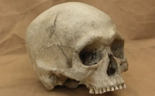 Археологи нашли голову ребёнка, который при жизни употреблял галлюциногенные растения
