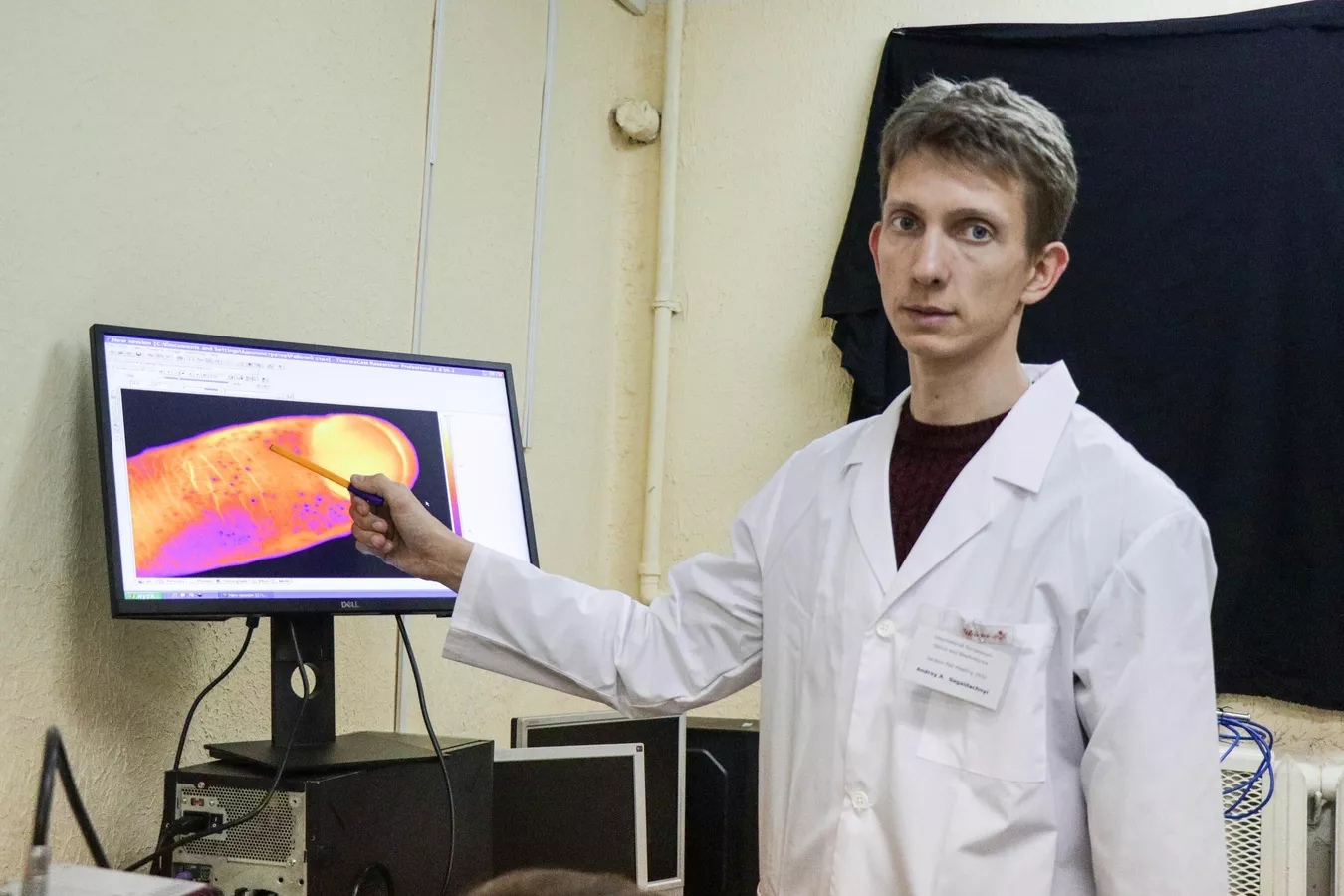 JTB: Учёные из российского СГУ научились мониторить поражение нервов по каплям пота
