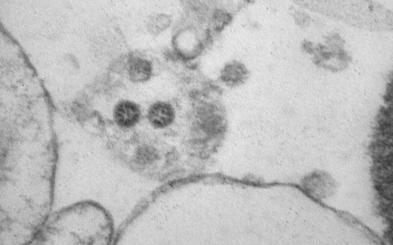 Bloomberg: новый штамм коронавируса SARS-CoV-2 может стать более заразным и смертельным