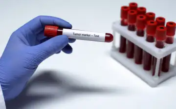 Учёные создали анализ крови, который определяет истинный возраст