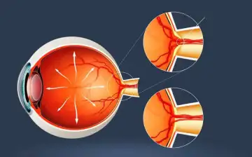 Aging Cell: стресс способствует ускорению процесса старения глаз и приводит к глаукоме