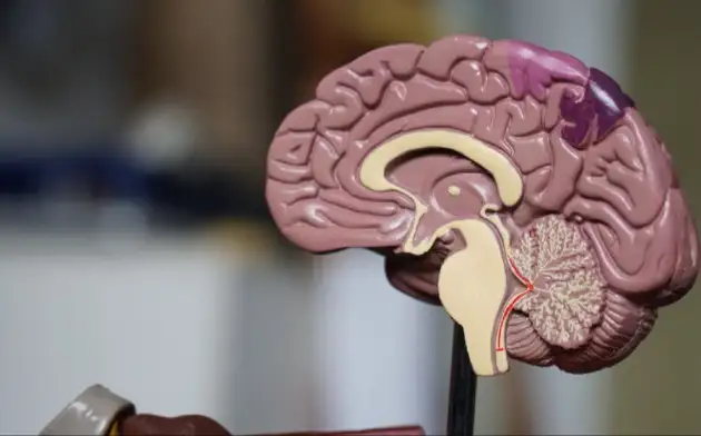 PNAS: у людей с синдромом Дауна найдены связанные с болезнью Альцгеймера прионы