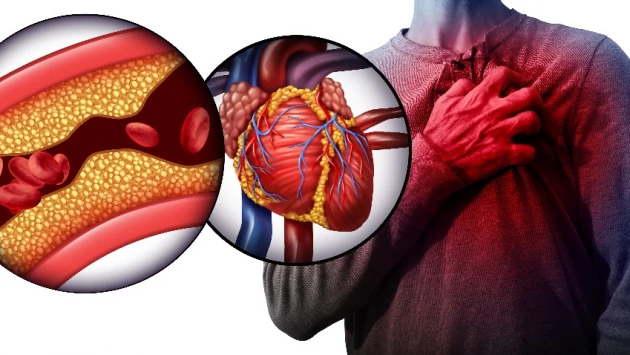 Кардиолог Кореневич назвала самые опасные симптомы без боли перед инфарктом