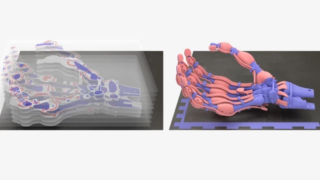 Ученые впервые напечатали на 3D-принтере руку с костями, связками и сухожилиями