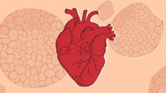 Daily Mail: псориаз замедляет кровоток и повышает риск развития заболеваний сердца