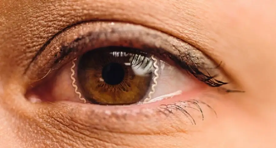 Умные мягкие контактные линзы могут решить глобальную проблему диагностики глаукомы