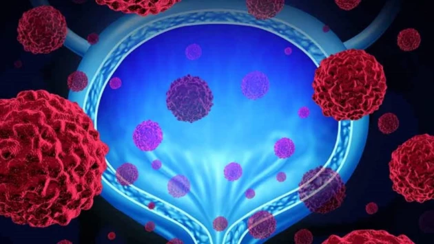JAMA: добавки витамина Е увеличивают риски рецидива рака мочевого пузыря