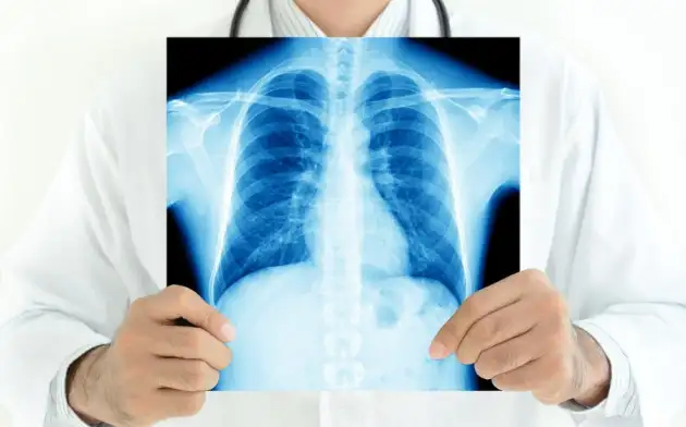 Искусственный интеллект наравне с рентгенологами справляется с выявлением туберкулёза