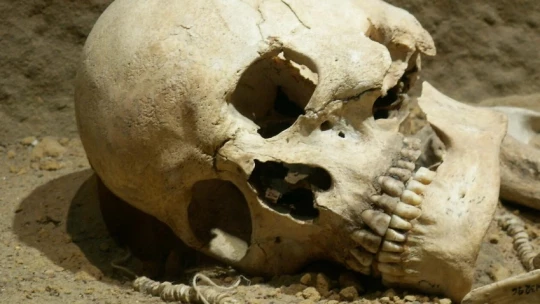 В черепе с Пиренейского полуострова римского периода ученые нашли опухоль