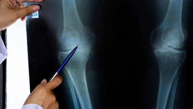 Создана инновация для диагностики остеоартрита коленного сустава