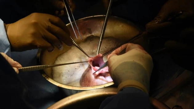Хирурги университета Мэриленда пересадили человеку сердце свиньи